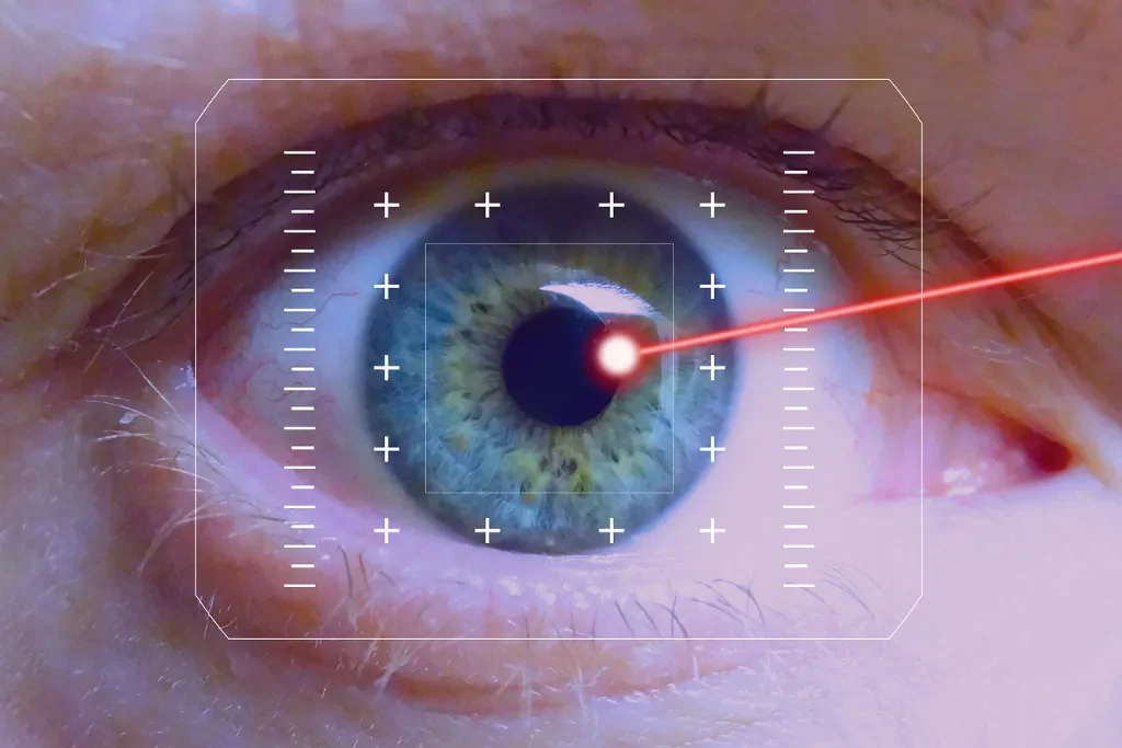Jak przygotować się do laserowej korekcji wzroku